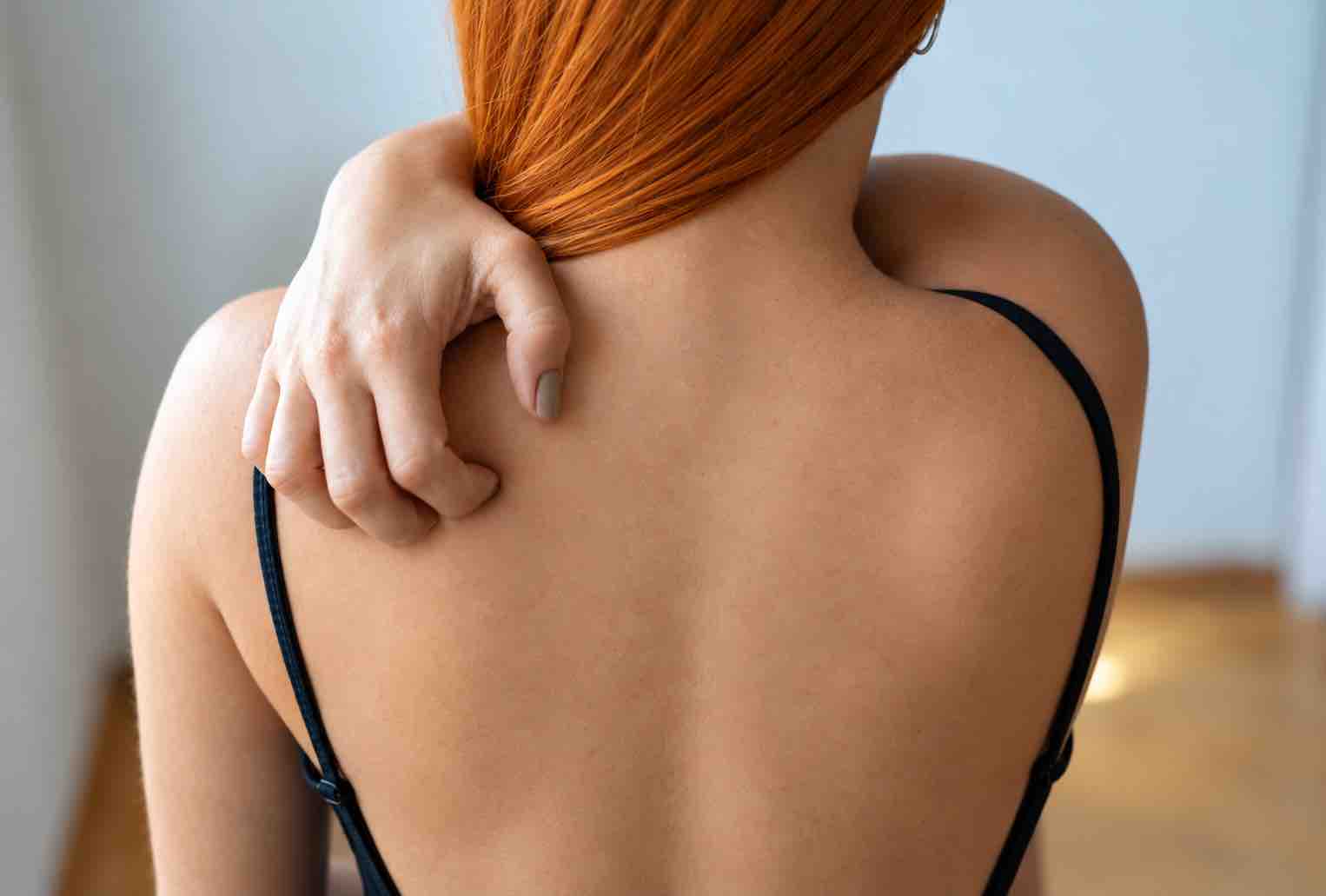 Traitement de l'eczéma avec un médecin à Écublens et dans l'Ouest lausannois