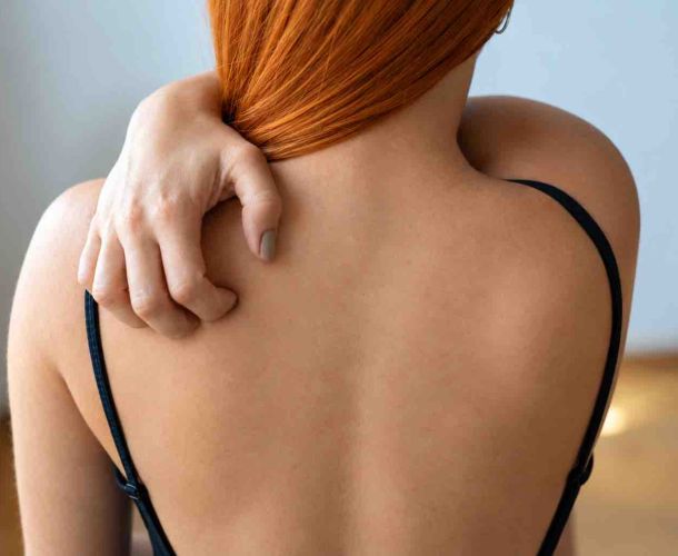 Traitement de l'eczéma avec un médecin à Écublens et dans l'Ouest lausannois